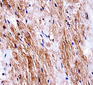 NSJ Bioreagents/Ddr2 Antibody (F44008)/0.08 ml/F44008-0.08ML