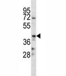 NSJ/CD86抗体（F44504）/F44504-0.4ML/0.4ML