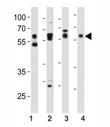 NSJ Bioreagents/SMAD2 Antibody (F52960)/0.08 ml/F52960-0.08ML