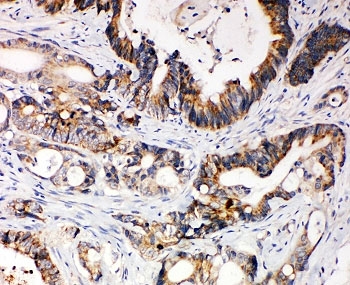 NSJ Bio/XIAP Antibody (R30585)/100 ug/R30585
