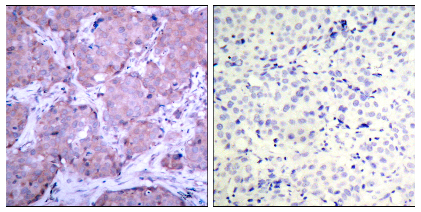 enogene/BRCA1 (Phospho-Ser1524) Antibody/100μg/100μl/E011117-2