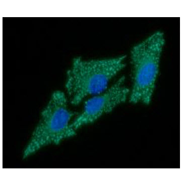 Nkmaxbio/Human HABP1/C1QBP antibody/100ul/ATGA0330-100ul