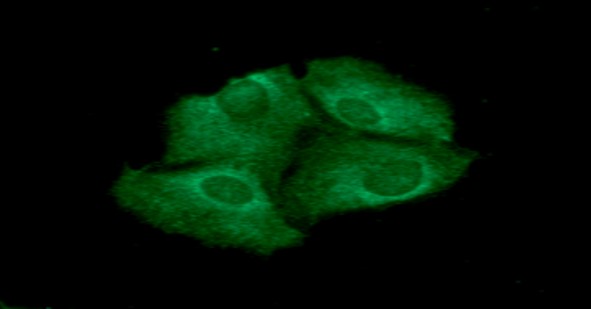 Nkmaxbio/Human Thioredoxin Reductase 1/TRXR1 antibody/100ul/ATGA0451-100ul