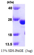 Nkmaxbio/Recombinant human Glutathione S-transferase kappa 1/GSTK1 protein/20ug/ATGP0464-20ug
