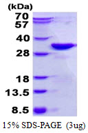 Nkmaxbio/Recombinant human DKK2 protein/4ug/ATGP1700-4ug