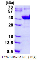 Nkmaxbio/Recombinant human NDUFAF1 protein/500ug/ATGP1775-500ug
