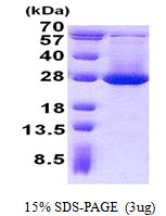 Nkmaxbio/Recombinant human ADI1 protein/500ug/ATGP1975-500ug